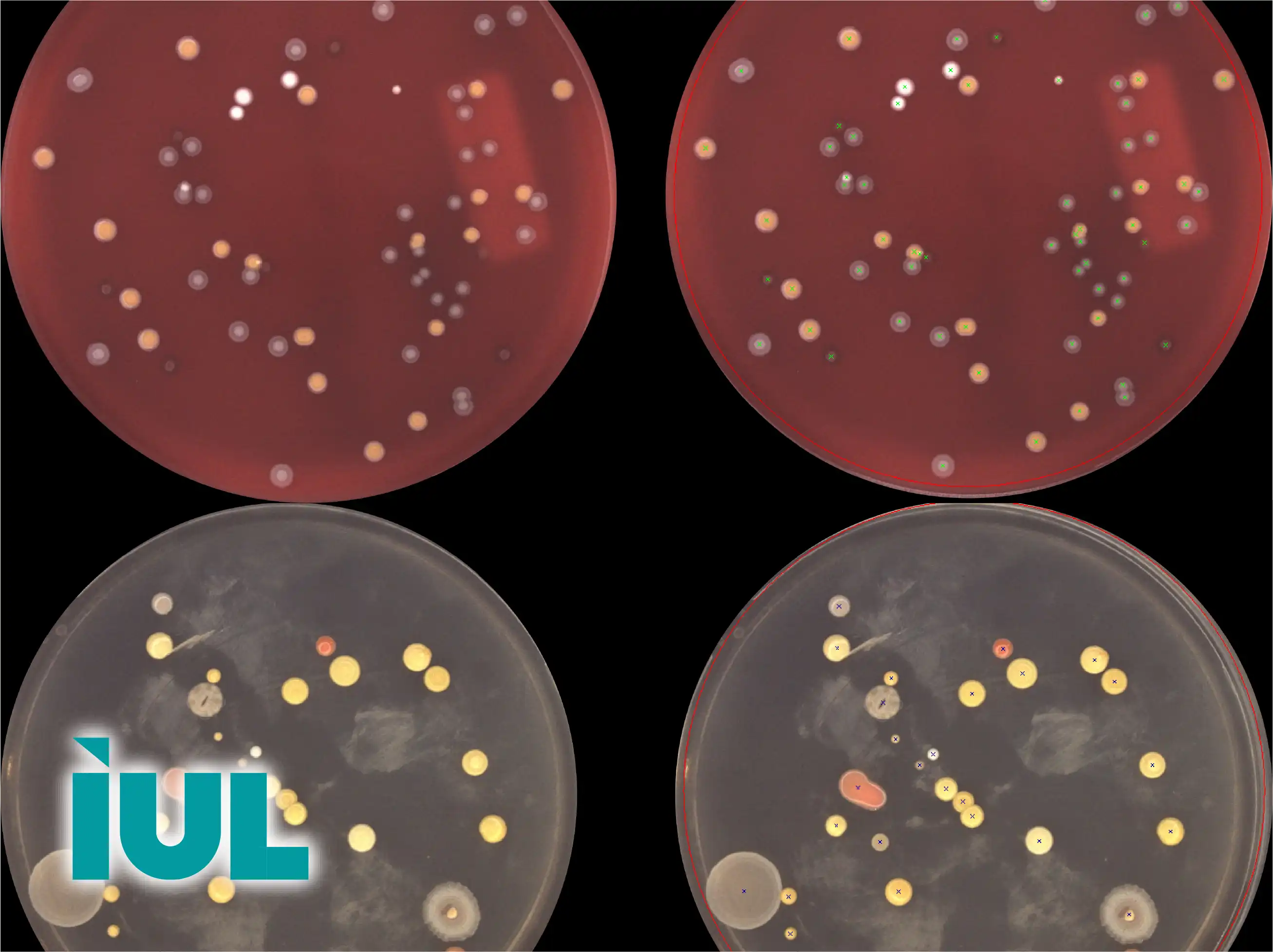 IUL Colony Counting & Zone Reading